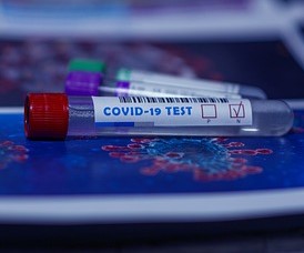 Covid-19, Conftrasporto: difficoltà e ritardi nel piano di distribuzione dei vaccini